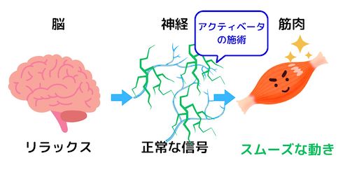 誤作動の施術後