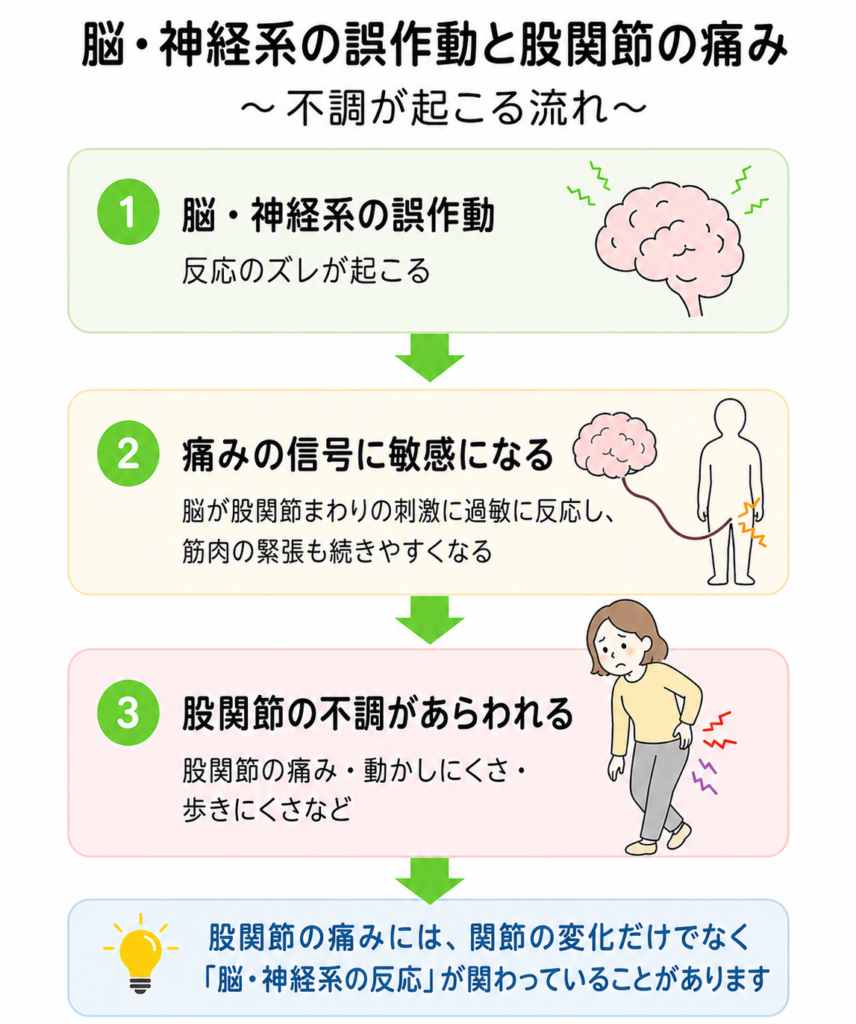 股関節の痛みと脳・神経系の誤作動の関係を表した図